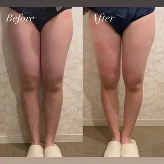 Tulipe Chihoのエステ・リラクイメージ