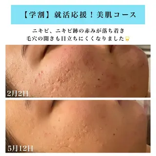 Bellesthe （ベルエステ）のエステ・リラクイメージ