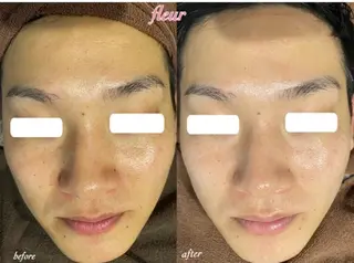 Fleur フルールのエステ・リラクイメージ