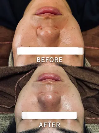 LukeBeauty salonのエステ・リラクイメージ