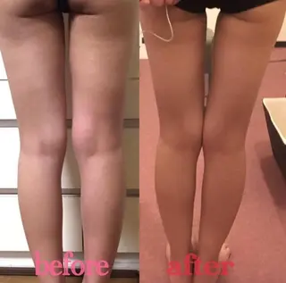 HappIness 遠赤外線ドームのエステ・リラクイメージ