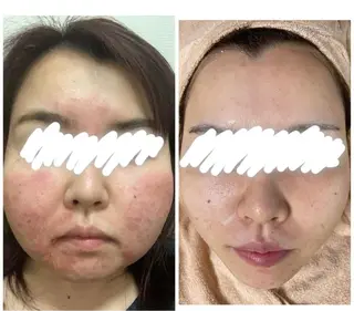 都度払い肌改善専門店 店長二上文香のエステ・リラクイメージ