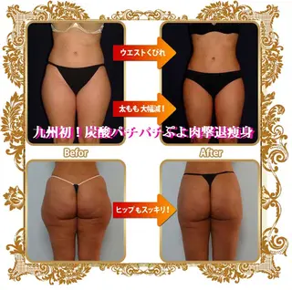 ボディ ブランドのエステ・リラクイメージ