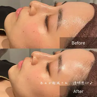 NA skin たまプラーザ　川島のエステ・リラクイメージ