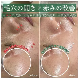 La Dusa 韓国肌管理/小波のエステ・リラクイメージ