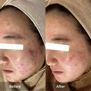 ハーブピーリング専門 MOKAのエステ・リラクイメージ