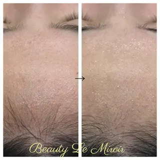 ビューティー ミロワールのエステ・リラクイメージ