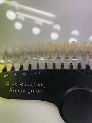 セルフホワイトニング エクシア 高田馬場のその他イメージ