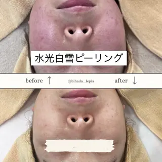 肌質管理専門店 Lé pia　AMIのエステ・リラクイメージ