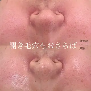 etre - 韓国肌管理 -のエステ・リラクイメージ