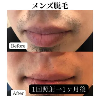 トータルビューティー サロンSalaのマツエク・マツパデザイン