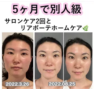 salondeBe 🩵フェイシャル専門のエステ・リラクイメージ