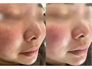 Belchic ベルシックのエステ・リラクイメージ