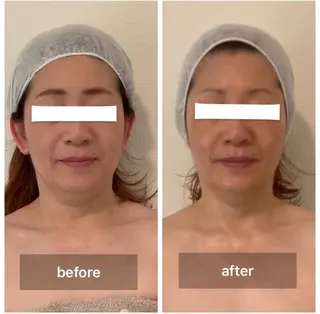 エクラヴィ 小顔・エイジングケアのエステ・リラクイメージ