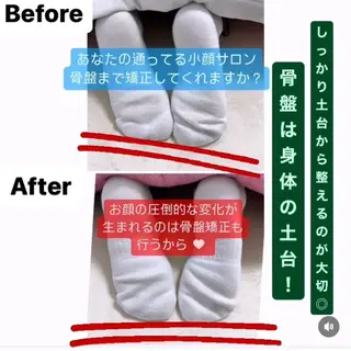 頭蓋骨から小さくする 小顔★専門サロンのエステ・リラクイメージ