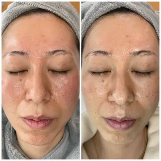 サロンピュア 所沢店のエステ・リラクイメージ