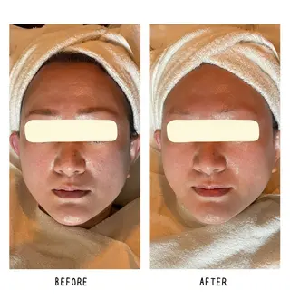 Yoshino Erinaのエステ・リラクイメージ