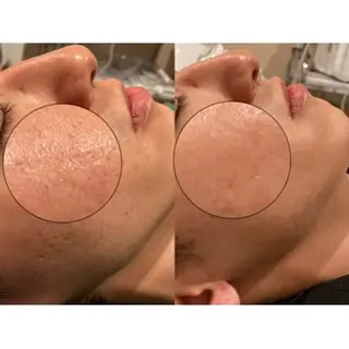 メンズ 【BUB立川】 ゆかのエステ・リラクイメージ