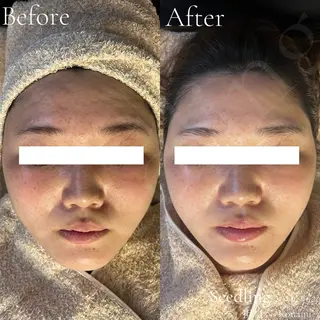 シードリン 府内店 小波のヘアスタイル