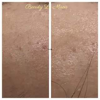 ビューティー ミロワールのエステ・リラクイメージ