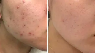 耳ツボ/体質改善/ 温活La mer月島のその他イメージ