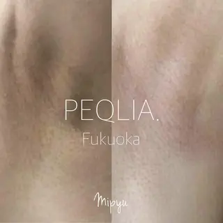 【フェムケア専門店】 PEQLIA福岡のエステ・リラクイメージ