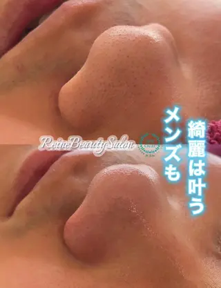 毛穴/シミ肝斑/脱毛 横山梨里のエステ・リラクイメージ