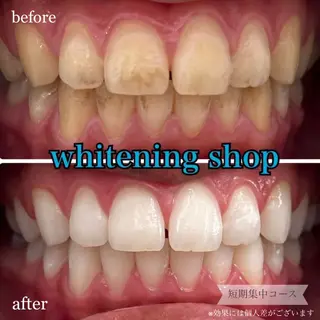 ホワイトニングショップ桜木町店所属・ホワイトニング ショップ桜木町店のその他イメージ