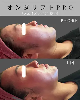 オンダリフト小顔･ ワックス脱毛×光脱毛のエステ・リラクイメージ