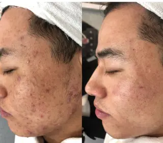 メンズ セルフエステ ALL in ONE所属・1組貸切 セルフエステのエステ・リラクイメージ