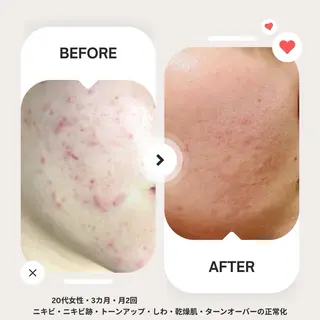 脱毛　Beauty salon Lumiere（ルミエール）所属・完全都度払い脱毛⭐︎ Lumiereのエステ・リラクイメージ