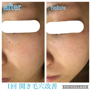 ロング カラー パーマ ヘアアレンジ キッズ ネイル マツエク・マツパ EnsorClair 代表 野口真央のエステ・リラクイメージ
