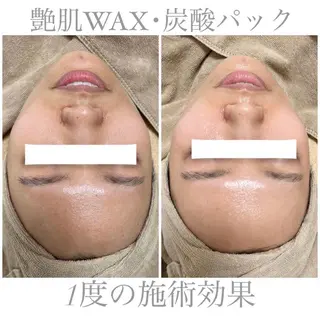 エステサロン Mi-mi.iのエステ・リラクイメージ