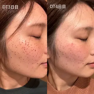 earth龍ヶ崎/ 脱毛/シミ取り🆕のエステ・リラクイメージ