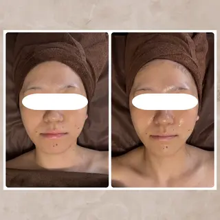 Vi's CLUB KOTONOのエステ・リラクイメージ