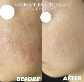 セミロング カラー パーマ ヘアアレンジ メンズ キッズ ネイル マツエク・マツパ アイブロウ NANIOAFU [なんば店］のその他イメージ