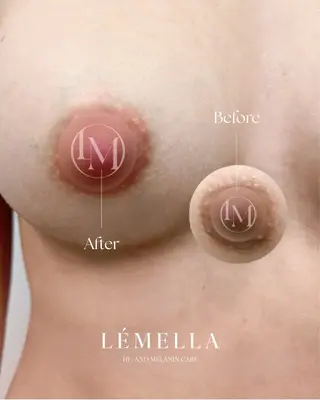 BLESS BEAUTYのエステ・リラクイメージ