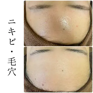 ハーブピーリング専門 BIOEL横浜のエステ・リラクイメージ