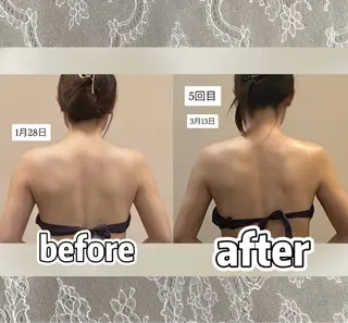 浮腫|肩こり|張り 日々の疲れを解消★のエステ・リラクイメージ