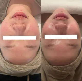 中目黒ハーブピーリン グ🌿ララピールのエステ・リラクイメージ