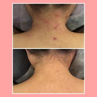 ショート カラー パーマ ヘアアレンジ メンズ キッズ ネイル マツエク・マツパ ニキビ・肌質改善専門 ♡人生が変わるサロンのエステ・リラクイメージ