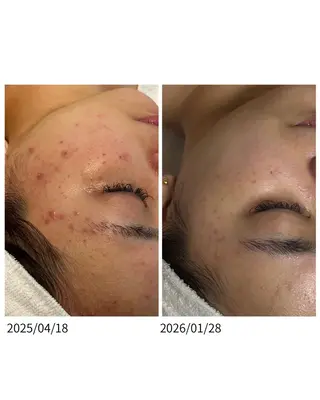 肌質改善サロン🫧 MAIのエステ・リラクイメージ