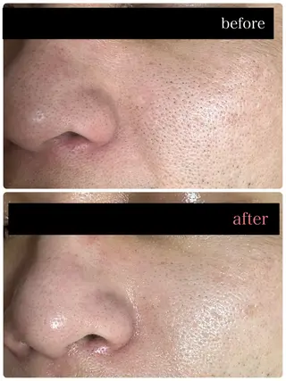 Re beaute所属・浜田 威代のエステ・リラクイメージ