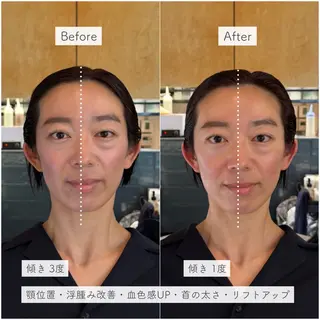 ショート 小顔矯正スパ/艶髪 湖香(コノカ)のエステ・リラクイメージ