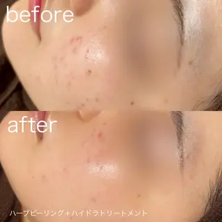 lulularico Yuのエステ・リラクイメージ
