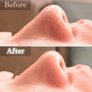 毛穴洗浄特化🫧 オオツカのエステ・リラクイメージ