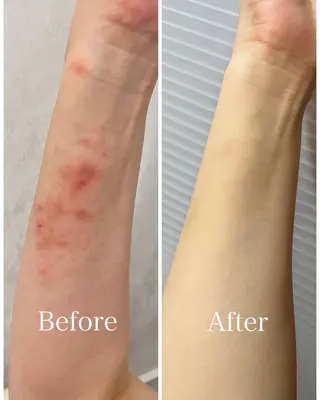 肌のお悩み改善サロン MELIA/朋美のエステ・リラクイメージ