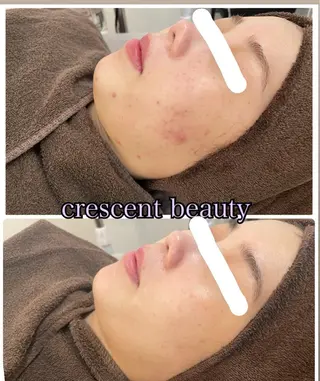 crescent 福寿のマツエク・マツパデザイン