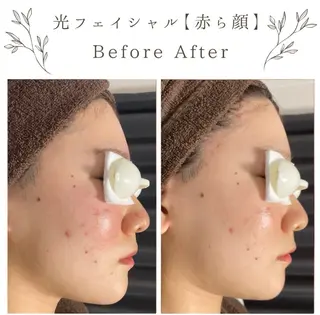 な ぎのエステ・リラクイメージ