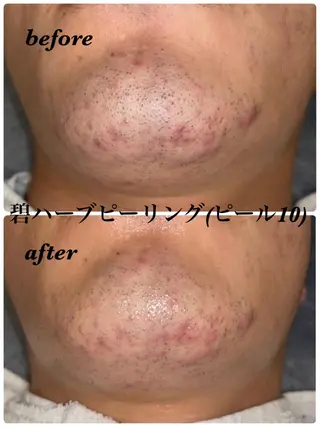 lady's&men's　beauty salon s.i.d所属・ビューティーサロン s.i.d深井店のエステ・リラクイメージ